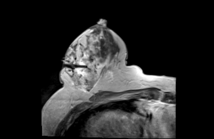 Mammographie / MRT / Tomosynthese | Röntgenpraxis im Tesdorpfhaus